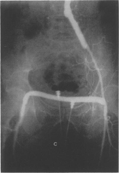 Fig. 1C.