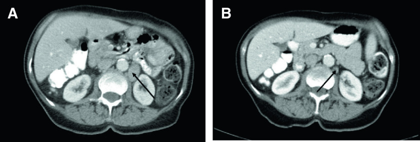 Fig 2.