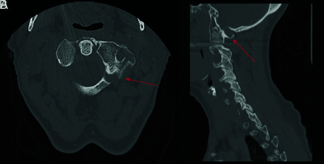 FIG 9.