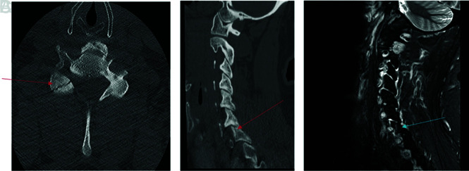 FIG 6.