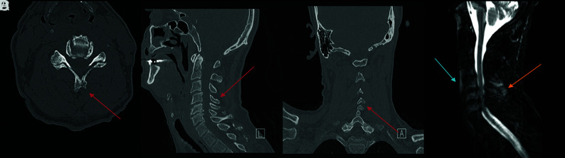 FIG 3.