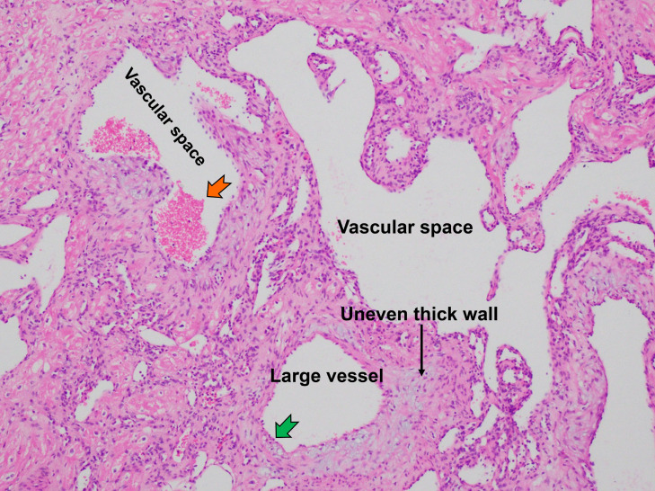 Fig 6
