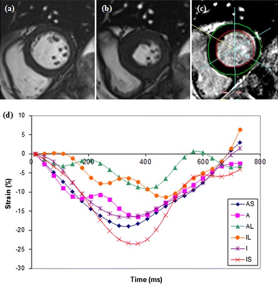 Fig. 1