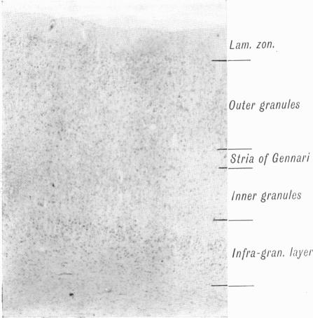 Fig. 14