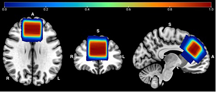 FIGURE 1