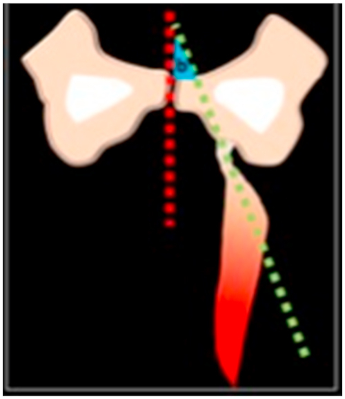 Fig. 3