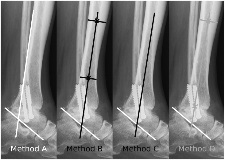 Fig 4