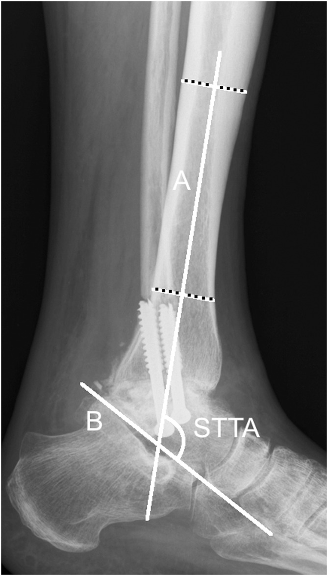 Fig 2