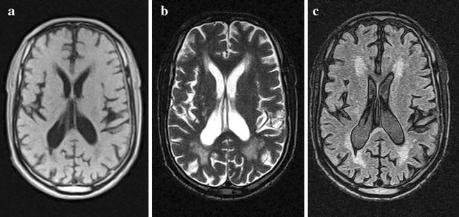 Fig. 1