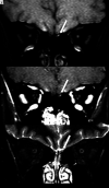 FIG 1.