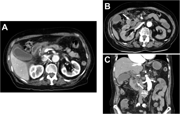 Fig. 2