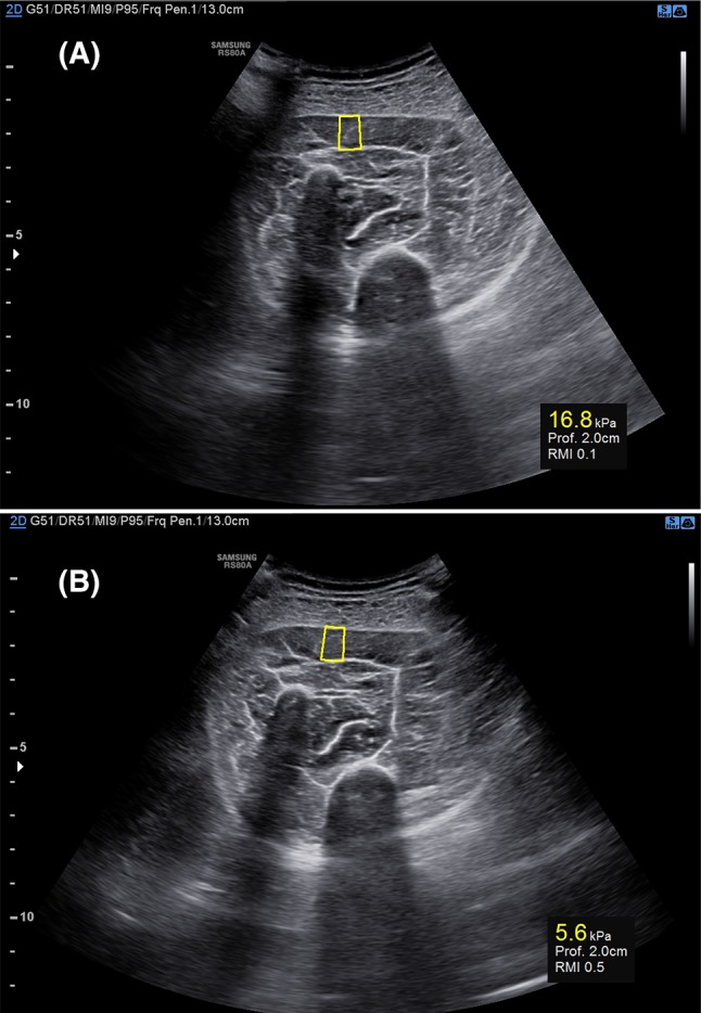 Fig. 2