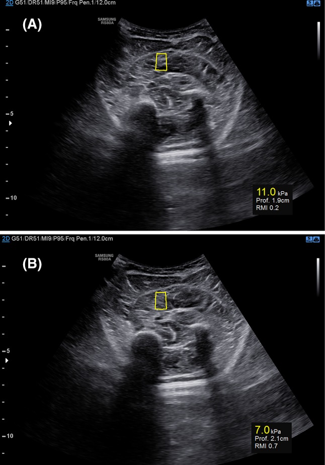 Fig. 1