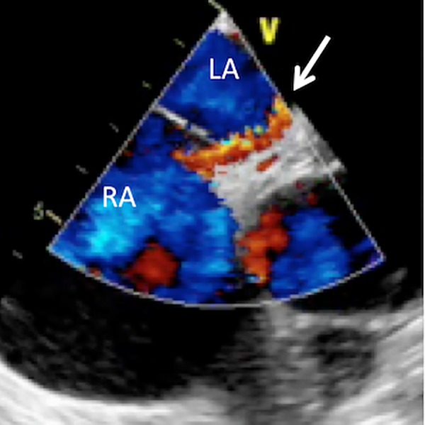 Figure 3