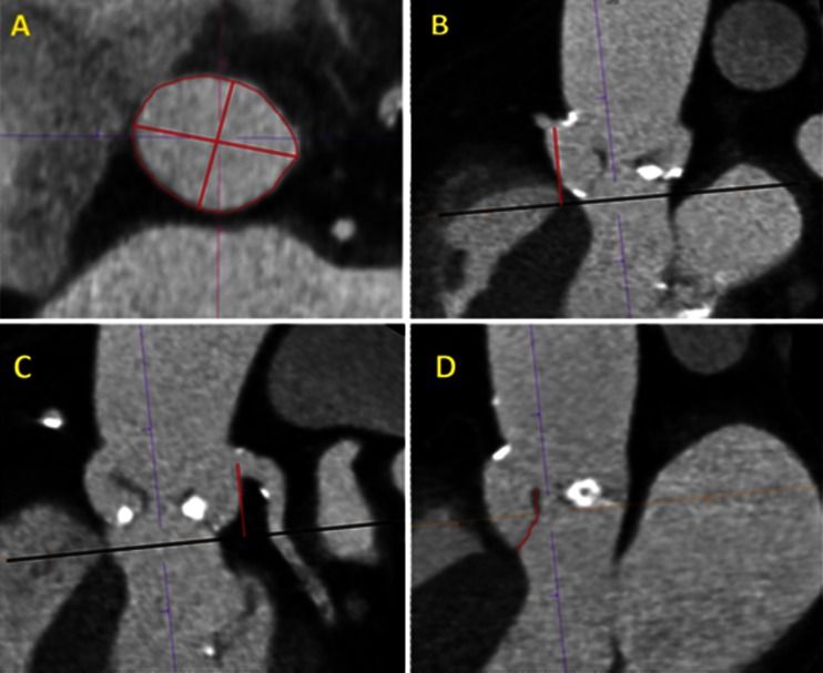 Fig. 1