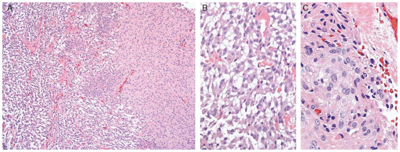 FIGURE 1