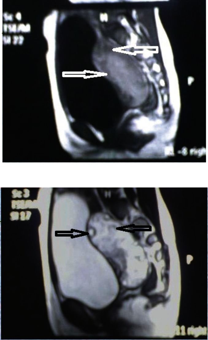 Figure 5 and 6: