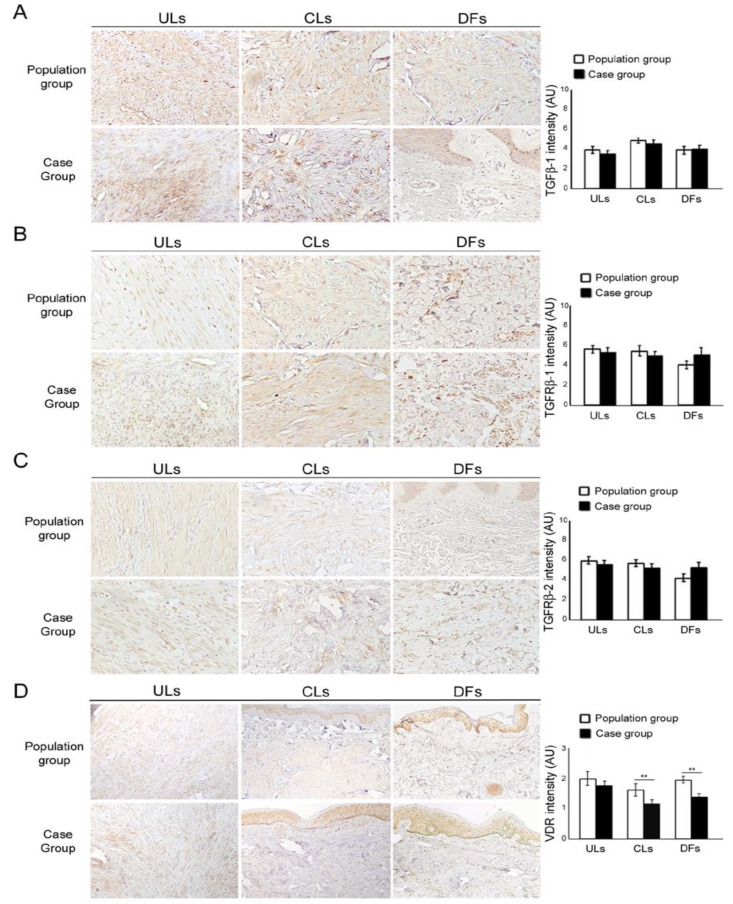 Increased Occurrence of Cutaneous Leiomyomas and Dermatofibromas in ...