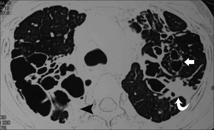 Figure 18