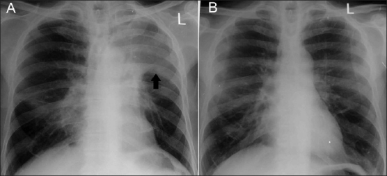 Figure 5 (A, B)