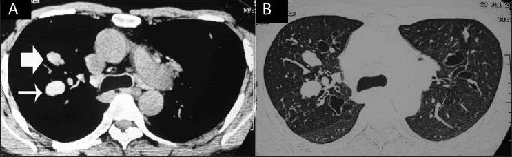 Figure 15 (A, B)