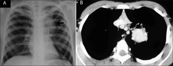 Figure 6 (A, B)