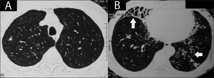 Figure 13(A, B)