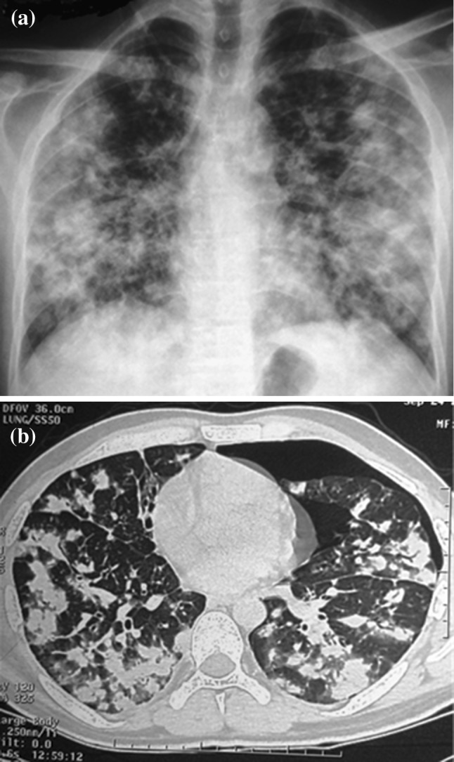 Fig. 1