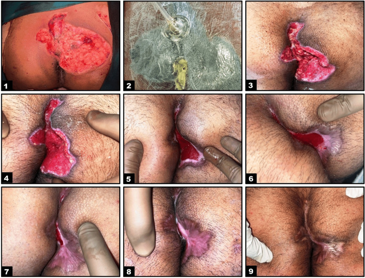 Figure 4