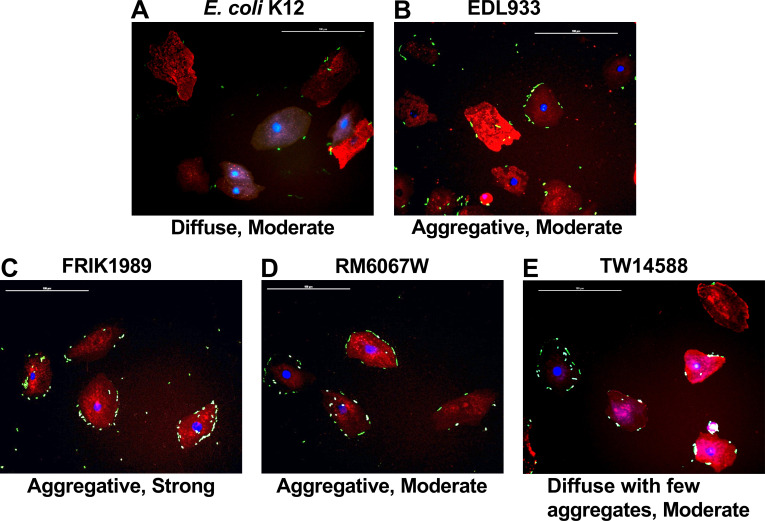 Fluorescent microscopy images depict different patterns of bacterial adherence to host cells for various E. coli isolates, characterized by diffuse and aggregative adherence with varying degrees of intensity.