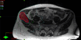 Fig. 3b