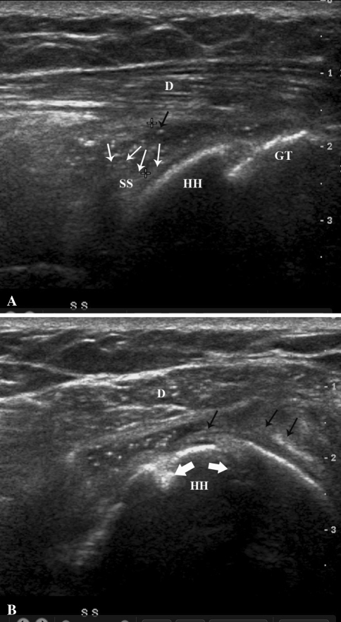 Fig. 2A–B