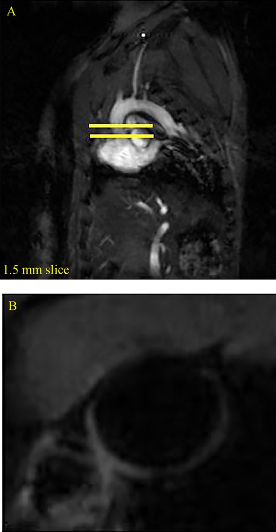 Fig.1