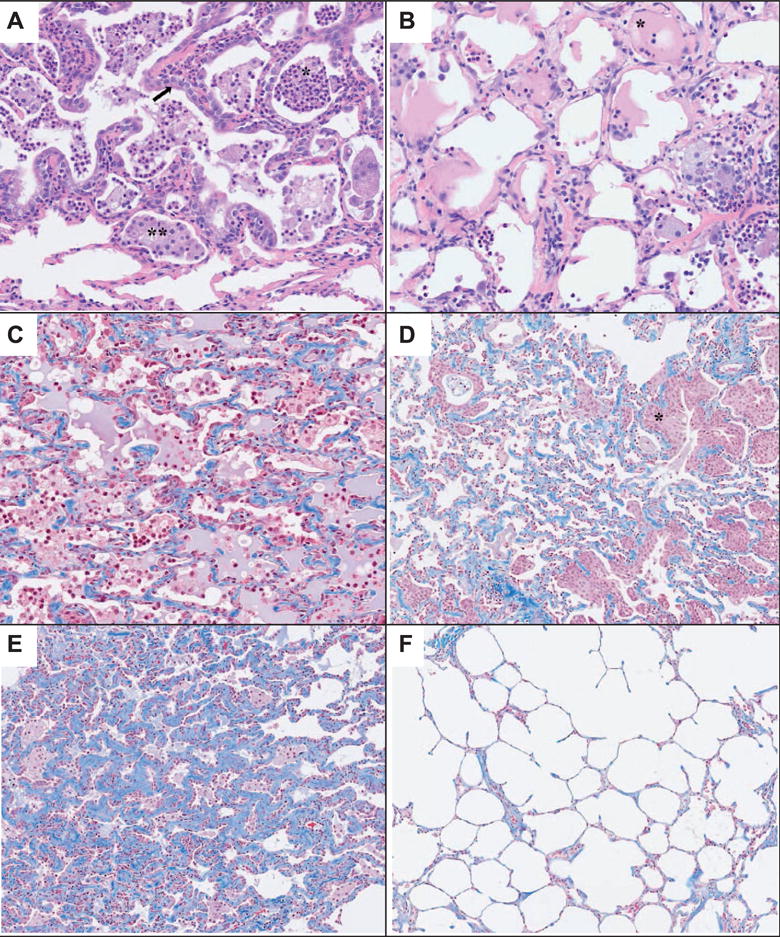 FIG. 8