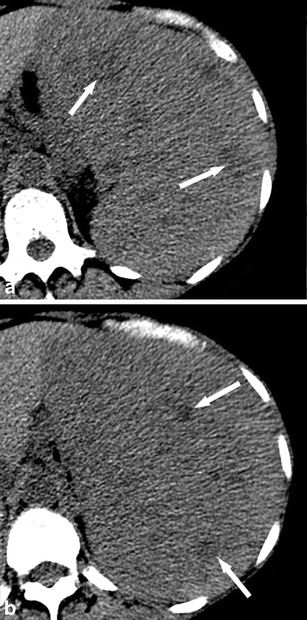 Fig. 11