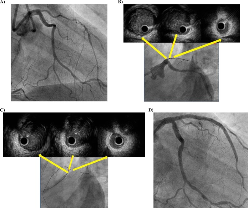 Fig. (1)