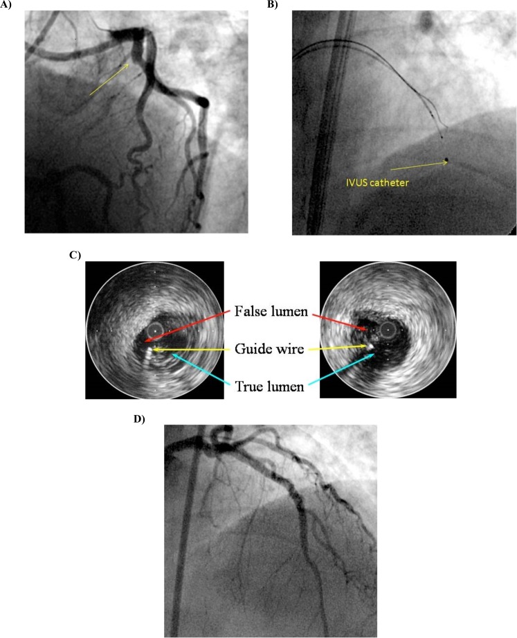 Fig. (2)