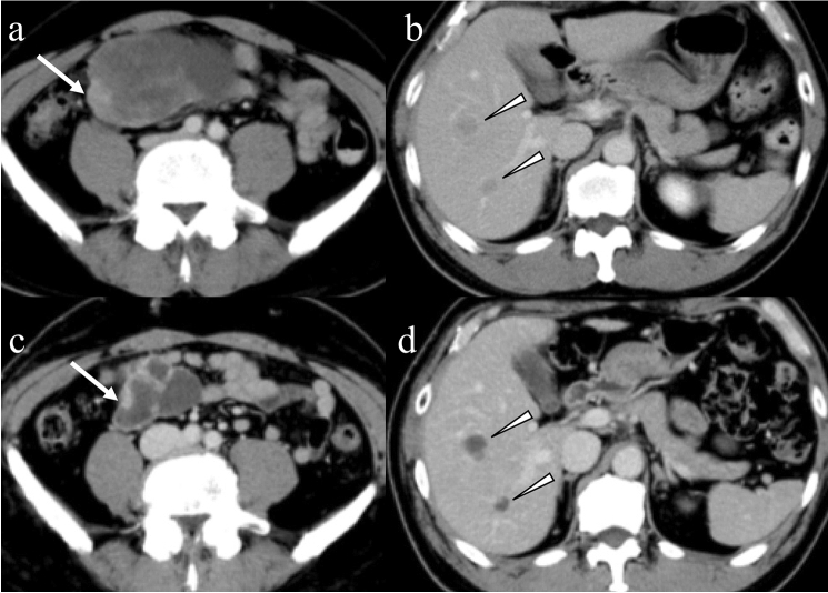 Fig. 10