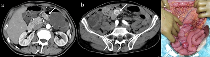 Fig. 11