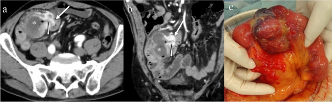 Fig. 14