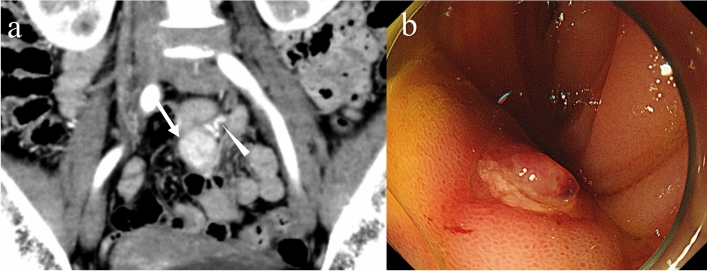 Fig. 13