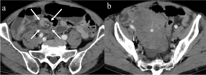 Fig. 15