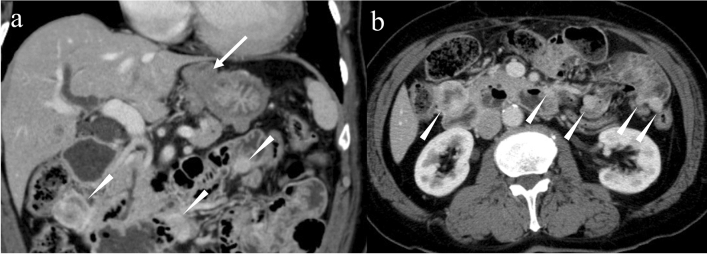 Fig. 12