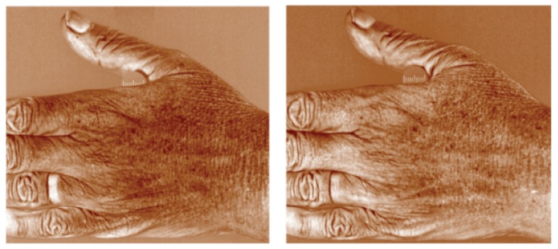 FIGURE 8.