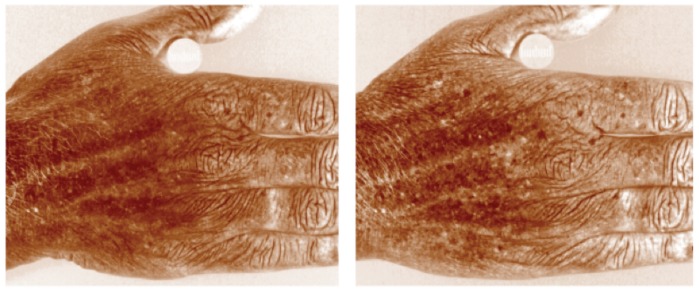FIGURE 4.
