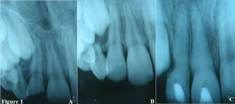 Fig. (1)