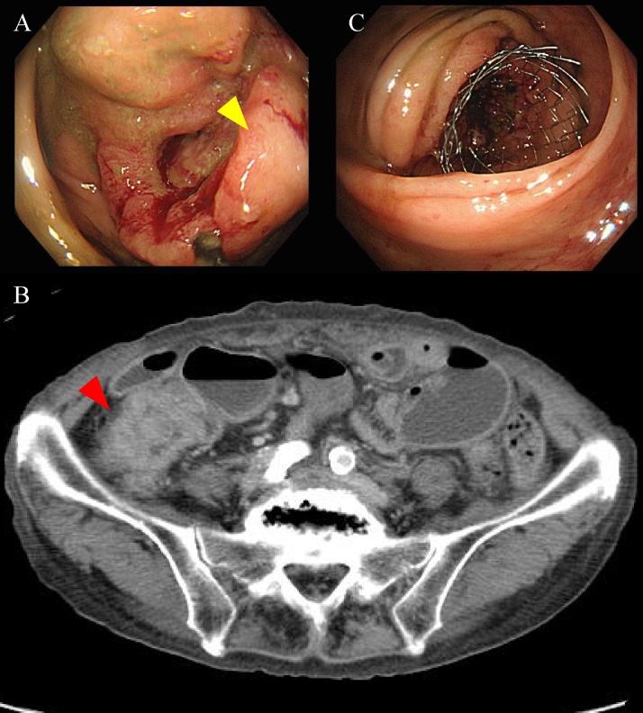 Fig. 1