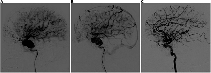 FIGURE 1