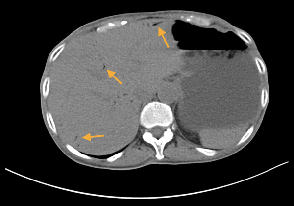 Figure 2.