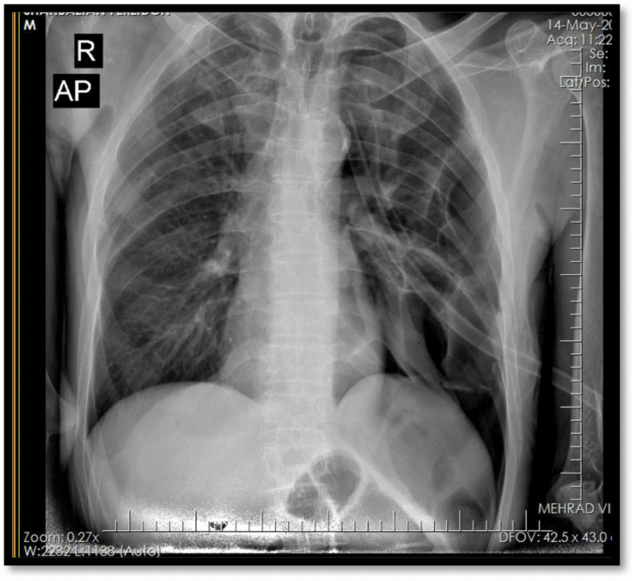 Fig. 5
